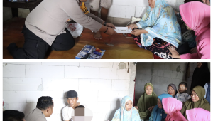 Nasib Penderita Tumor Mata, Kapolres AKBP Haryo Basuki Biayai Pengobatan Balita